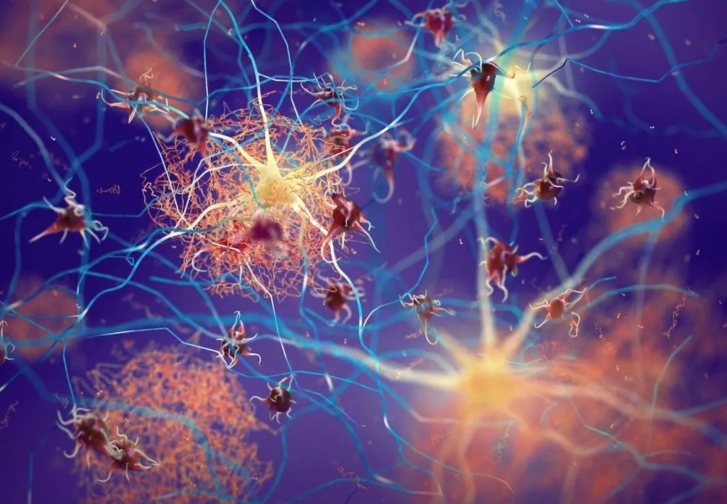 واکسن زونا خطر ابتلا به زوال عقل را ۲۰ درصد کاهش می‌دهد