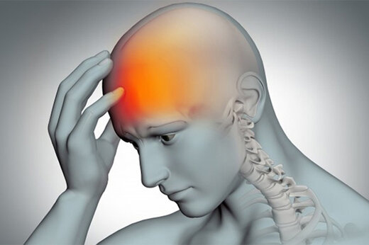 هشدار نسبت به شیوع بالای سردرد در بین نوجوانان کشور