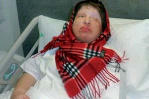 آمنه بهرامی :اگر دوباره بتوانم ببینم  آن را عنایت حضرت ابوالفضل(ع) و امام رضا(ع) می دانم