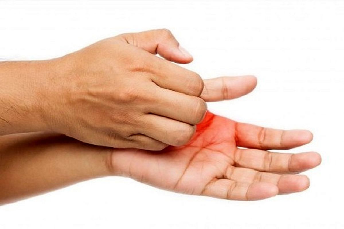 چرا کف دست و پای بعضی افراد بیش از حد عرق می کند؟!